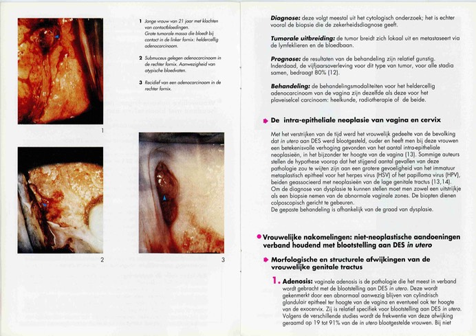 brochure-des-volksgezond006