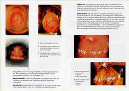 brochure-des-volksgezond007