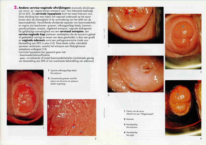 brochure-des-volksgezond008