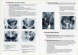 brochure-des-volksgezond009